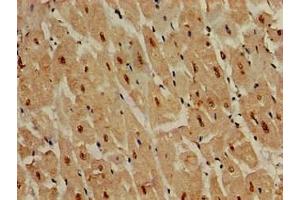 Immunohistochemistry of paraffin-embedded human heart tissue using ABIN7150025 at dilution of 1:100