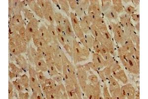 Immunohistochemistry of paraffin-embedded human heart tissue using ABIN7150025 at dilution of 1:100 (DDR2 anticorps  (AA 447-540))