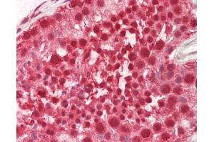 Human Testis: Formalin-Fixed, Paraffin-Embedded (FFPE).