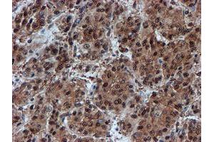 Image no. 2 for anti-Proteasome Subunit alpha 6 (PSMA6) antibody (ABIN1500464)