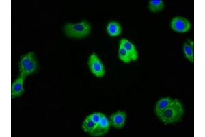 Immunofluorescence staining of HepG2 cells with ABIN7156745 at 1:100, counter-stained with DAPI. (IL1R1 anticorps  (AA 18-320))