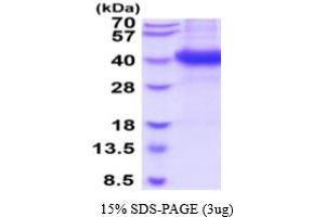 SDS-PAGE (SDS) image for neonatal Fc Receptor (FcRn) (AA 22-297) protein (His tag) (ABIN5854760)