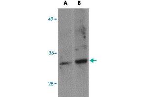 Western blot analysis of SKA1 in A-549 NE cell lysate with SKA1 polyclonal antibody  at (A) 0. (SKA1 anticorps  (C-Term))