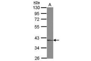 Image no. 2 for anti-Decapping Enzyme, Scavenger (DCPS) (AA 1-149) antibody (ABIN1497779) (DCPS anticorps  (AA 1-149))