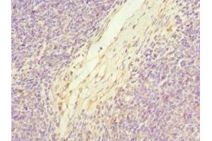 Immunohistochemistry of paraffin-embedded human thymus tissue using ABIN7174771 at dilution of 1:100 (C19orf48 anticorps  (AA 1-117))