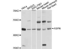 Western blot analysis of extracts of various cell lines, using ASPN antibody (ABIN4902960) at 1:1000 dilution. (Asporin anticorps)