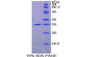 SDS-PAGE analysis of Rat GSTk1 Protein. (GSTK1 Protéine)