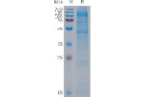 Human Protein, His Tag on SDS-PAGE under reducing condition.