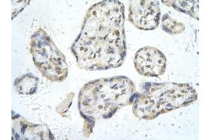 Rabbit Anti-PPARD antibody        Paraffin Embedded Tissue:  Human Placenta cell   Cellular Data:  Epithelial cells of renal tubule  Antibody Concentration:   4.