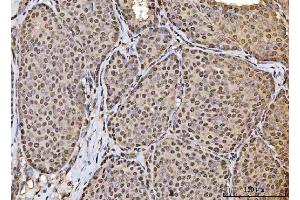IHC analysis of HOXC4 using anti-HOXC4 antibody (ABIN7603059). (HOXC4 anticorps  (Middle Region))