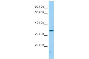 Host: Rabbit Target Name: FCGR2C Sample Type: Hela Whole cell lysates Antibody Dilution: 1. (FCGR2C anticorps  (N-Term))