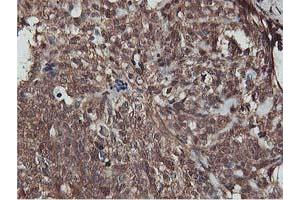 Immunohistochemistry (IHC) image for anti-V-Akt Murine Thymoma Viral Oncogene Homolog 1 (AKT1) antibody (ABIN1496556) (AKT1 anticorps)
