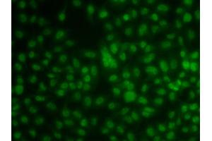 Immunofluorescence analysis of A549 cells using KLF3 antibody (ABIN5974328). (KLF3 anticorps)