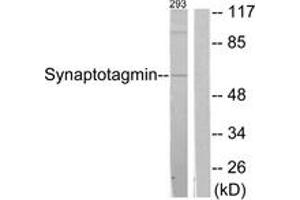 Western blot analysis of extracts from 293 cells, treated with Forskolin 40nM 30', using Synaptotagmin (Ab-309) Antibody. (Synaptotagmin anticorps  (AA 276-325))