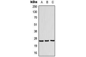 Western blot analysis of Translin expression in MCF7 (A), HeLa (B), HepG2 (C) whole cell lysates. (Translin anticorps  (Center))