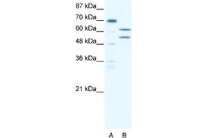 Western Blotting (WB) image for anti-Zinc Finger and BTB Domain Containing 43 (ZBTB43) antibody (ABIN2460282) (ZBTB43 anticorps)