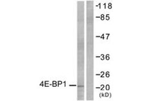 Western blot analysis of extracts from MDA-MB-435 cells, treated with EGF 200ng/ml 30', using 4E-BP1 (Ab-36) Antibody. (eIF4EBP1 anticorps  (AA 4-53))