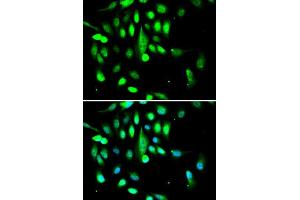Immunofluorescence analysis of A549 cells using CDK1 antibody.