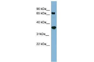 WB Suggested Anti-PPP2R1B Antibody Titration: 0. (PPP2R1B anticorps  (N-Term))