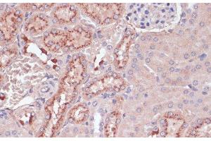 Immunohistochemistry of paraffin-embedded Mouse kidney using LYZ Polyclonal Antibody at dilution of 1:100 (40x lens). (LYZ anticorps)