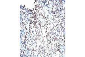 Stained with purified Mouse anti-VHL. (VHL anticorps  (AA 1-213))