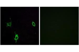 Immunofluorescence (IF) image for anti-Laminin, gamma 3 (LAMC3) (AA 1361-1410) antibody (ABIN2890006) (LAMC3 anticorps  (AA 1361-1410))