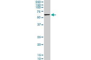 KLF11 monoclonal antibody (M02), clone 10C5. (KLF11 anticorps  (AA 404-512))