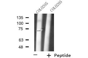 Western blot analysis of extracts from COLO205 cells, using RAP1GDS1 antibody.