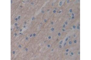 IHC-P analysis of Human Tissue, with DAB staining. (SFRP4 anticorps  (AA 22-346))