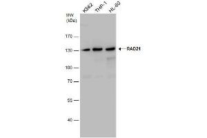 WB Image RAD21 antibody detects RAD21 protein by western blot analysis.