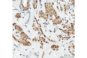 IHC analysis of Aurora A/AURKA using anti-Aurora A/AURKA antibody (ABIN7600751). (Aurora A anticorps  (AA 23-403))