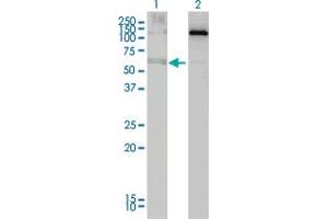 Western Blot analysis of ALAS2 expression in transfected 293T cell line by ALAS2 monoclonal antibody (M01), clone 6C1. (ALAS2 anticorps  (AA 1-100))