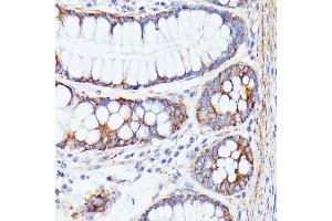 Immunohistochemistry of paraffin-embedded human colon using PTP4 antibody (ABIN7269703) at dilution of 1:100 (40x lens).