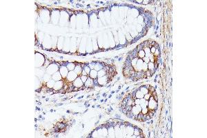 Immunohistochemistry of paraffin-embedded human colon using PTP4 antibody (ABIN7269703) at dilution of 1:100 (40x lens). (PTP4A2 anticorps  (AA 30-100))