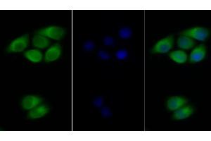 Detection of IFNa/bR2 in Human MCF7 cell using Polyclonal Antibody to Interferon Alpha/Beta Receptor 2 (IFNa/bR2)
