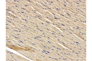 ABIN7096271 and ABIN7100333 at 1/100 staining rat muscle tissue by IHC-P. (RNF145 anticorps)