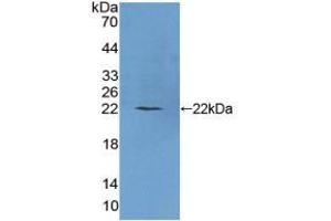 Figure. (Phospholipase C beta 1 anticorps  (AA 316-476))