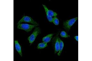 IF analysis of GSTM1 using anti-GSTM1 antibody (ABIN5693234). (GSTM1 anticorps)