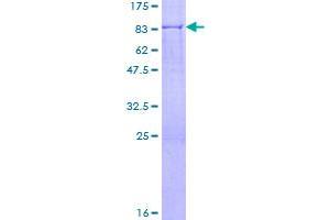 Image no. 1 for Glutathione Reductase (GSR) (AA 1-522) protein (GST tag) (ABIN1306052)