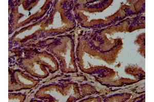 IHC image of ABIN7154699 diluted at 1:500 and staining in paraffin-embedded human prostate tissue performed on a Leica BondTM system.