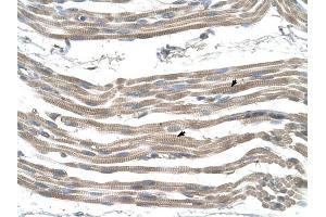 SLC25A22 antibody was used for immunohistochemistry at a concentration of 4-8 ug/ml to stain Skeletal muscle cells (arrows) in Human Muscle. (SLC25A22 anticorps)