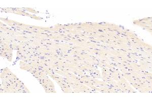 Detection of ATG7 in Mouse Heart Tissue using Polyclonal Antibody to Autophagy Related Protein 7 (ATG7)
