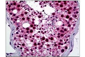 Immunohistochemistry (IHC) image for anti-NIMA (Never in Mitosis Gene A)-Related Kinase 2 (NEK2) (AA 331-445) antibody (ABIN781938)