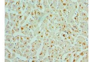Immunohistochemistry of paraffin-embedded human heart tissue using ABIN7142986 at dilution of 1:100