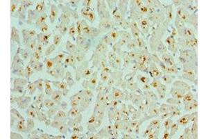 Immunohistochemistry of paraffin-embedded human heart tissue using ABIN7142986 at dilution of 1:100 (ASAH1 anticorps  (AA 146-395))
