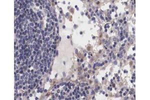 ABIN6267239 at 1/200 staining human Lymph node tissue sections by IHC-P. (JAK2 anticorps  (pTyr1007))