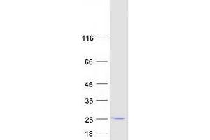 Validation with Western Blot