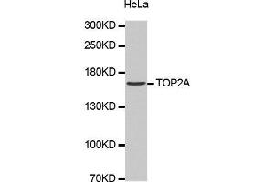 Western Blotting (WB) image for anti-Topoisomerase (DNA) II alpha 170kDa (TOP2A) antibody (ABIN1683096) (Topoisomerase II alpha anticorps)