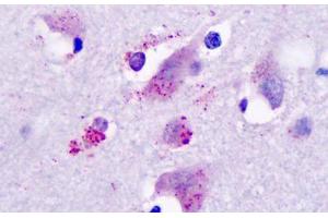 Anti-Histamine 3 Receptor / HRH3 antibody IHC staining of human brain, neurons and glia. (HRH3 anticorps  (Cytoplasmic Domain))