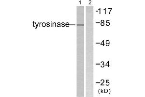Western blot analysis of extracts from COS7 cells, treated with UV (30mins), using Tyrosinase antibody. (TYR anticorps  (C-Term))